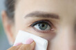 Young woman wipes face with cleaning napkin closeup