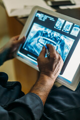 dentist using digital tablet x-ray