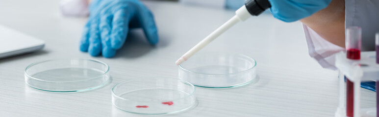 Wall Mural - Cropped view of scientist in latex gloves holding pipette near petri dishes, banner