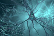 Neurons in Alzheimer's disease. 3D illustration