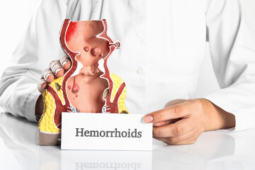 Wall Mural - Doctor holding card with word Hemorrhoids and model of unhealthy lower rectum on white background, closeup