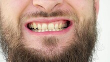 Happy Caucasian Man With A Beard Close-up Shows Healthy And Yellow Teeth. The Smile Of An Adult Guy. Face Close Up Of Smiling Teeth Isolated Detail. 