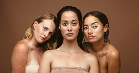 Wall Mural - skin problems can be caused by stress