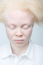 Close-up Of Albino Woman With Eyes Closed