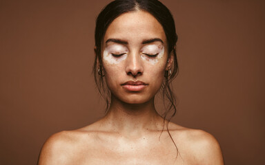 Wall Mural - embrace your skin condition