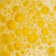 High color urine with bubbles. Foamy urine.