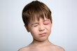 A boy with swollen eye from insect bite. Quincke edema. Portrait of Caucasian appearance child looking at the camera. Studio background. Isolated. Face of allergic person. Copy space. Studio. Allergy