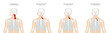 Anatomie - Muskulatur des Menschen - Halsmuskulatur mit deutscher Beschriftung