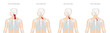 Anatomie - Muskulatur des Menschen - Halsmuskulatur mit lateinischer Beschriftung