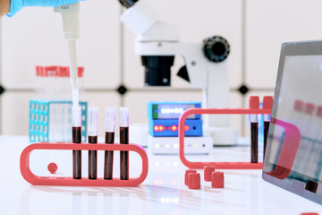 Wall Mural - Blood test for hormones and microelements in a biochemical laboratory. Test tubes with blood in the hand of a laboratory assistant and a microscope on the background