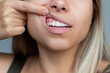 © Марина Демешко - Gum health. Close-up of a young woman showing healthy gums. Dentistry, dental care