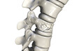 Spinal fracture, traumatic vertebral injury, illustration
