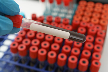 Poster - A test tube with a blood sample with empty label in the doctor's hand on the background of medical documents