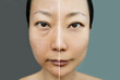 Concept Of Skin Rejuvenation. Before And After Cosmetic Operation. Whitening cream for Asian women.