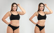 © New Africa - Collage with photos of woman before and after weight loss diet on light grey background