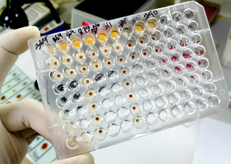 Poster - Hemagglutination assay for T. pallidum antibodies. TPHA. ELISA plate, serology testing method in medical laboratory