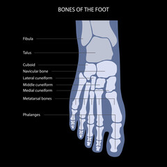 Poster - Foot bones anatomy