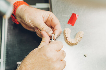 Aerial view of a hands adjusting a dental mould using an electric micromotor in a dental laboratory of porcelain crowns