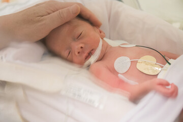 premature newborn baby in incubator (soft)