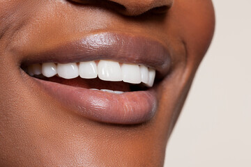 close up of female toothy smile