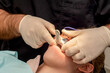 Otrhodontist or dentist making a teeth impression mold. Orthodontic treatment. Dental impression tray