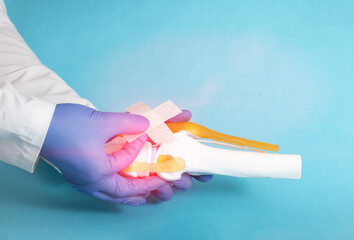 Wall Mural - Doctor traumatologist orthopedist glues a medical plaster on the knee joint mockup on a blue background. The concept of treating knees for arthrosis and arthritis, relieving inflammation. 