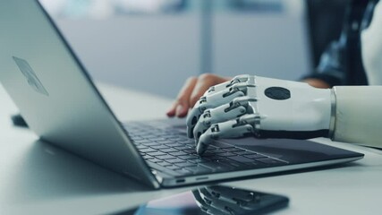 Poster - Close-up on Hands: Person with Disability Using Prosthetic Arm to Work on Laptop Computer. Specialist Swift and Natural Use of Thought Controlled Body Powered Myoelectric Bionic Hand. Side View