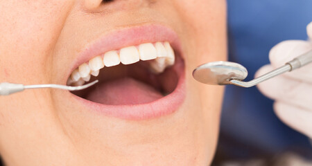 Close up view of dentist treating teeth of hispanic woman in dentist office