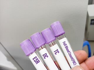 Sticker - Blood sample tube for Full Blood Count(FBC). CBC, Hemoglobin, ESR