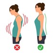 Correct and incorrect standing posture.Cervical spinal curvature. Hump. Healthy back.Vector illustration on white background.
