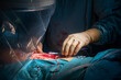 © karegg - vascular operation is performed in an operating room