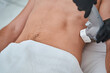 © Svitlana - Male patient undergoing the non-invasive body contouring