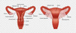 Realistic image of female human reproductive system with description isolated on transparent background