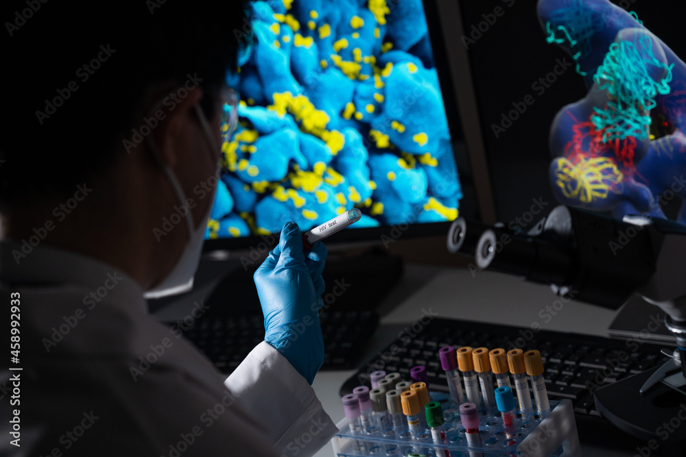 Blood tests to detect sexually transmitted diseases or STDs: hepatitis ...