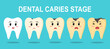 Dental caries stage cartoon character concept vector illustration. 