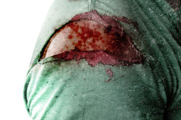  Zombie body with wound