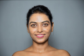 Indian smiling woman with her pimples, acne and dark spots