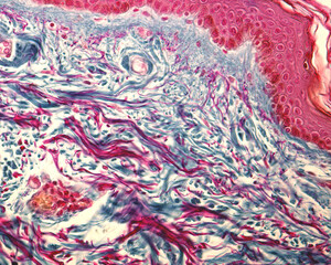 Poster - Collagen and elastic fibers. Cajal-Gallego trichrome