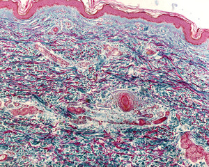 Poster - Collagen and elastic fibers. Cajal-Gallego trichrome