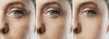 Female Face After Incredible Rejuvenation Process Or Heavy Retouching
