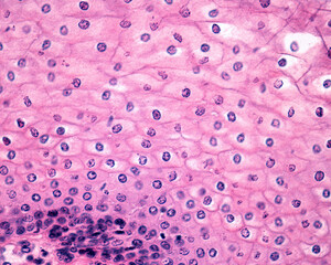 Poster - Vagina. Epithelium