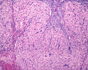 Poster - Corpus luteum. Granulosa-lutein and theca-lutein cells