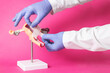 © HENADZY - The doctor holds a cross from a medical plaster in medical gloves on a pink background. Concept for the treatment of intimate problems in a girl, vaginal polyp
