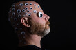 © Mat Hayward - Bald man with head covered in googly eyes