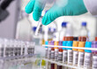 © Andrew Brookes/Westend61 - Hand of scientist wearing protective glove picking up sample in laboratory