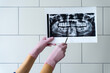 © Ivan Ozerov/Stocksy - Doctor showing teeth X ray