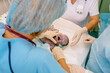 Baby being born via Caesarean Section coming out or baby minutes after the birth. Unrecognizable doctors examines a newborn baby boy in the first few minutes of life at hospital.