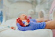 © Iryna - Macro photo of doctor's hands and legs of a child. Newborn is placed in the incubator. Neonatal intensive care unit