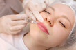 © Roman - A beautiful girl is given beauty injections in the lips A master cosmetologist gives an injection to increase the lips of hyaluronic acid