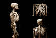 Human skeleton partner anatomical death abstract isloated partner